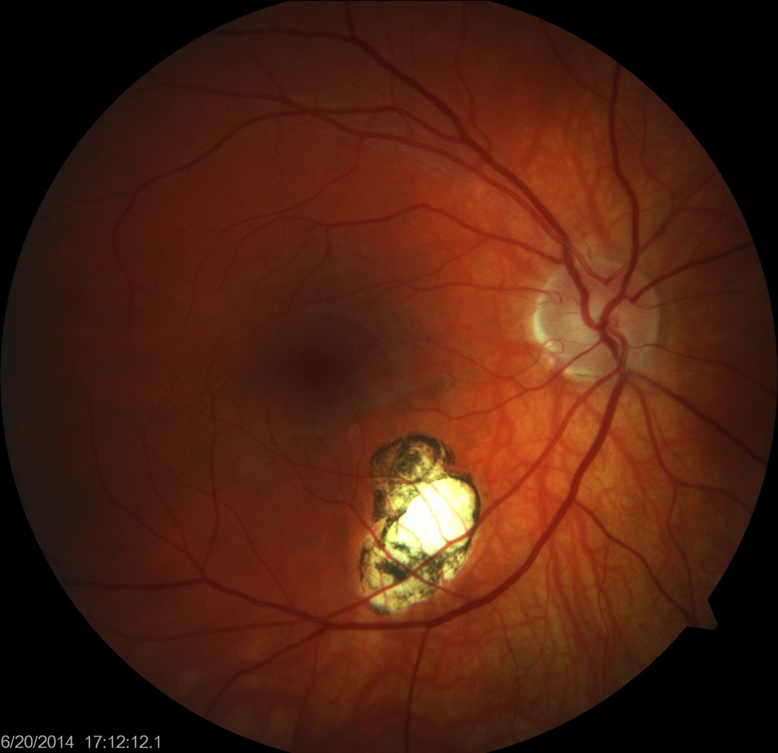 Library of Eye Disease Images and Videos - 918EyeDoctor